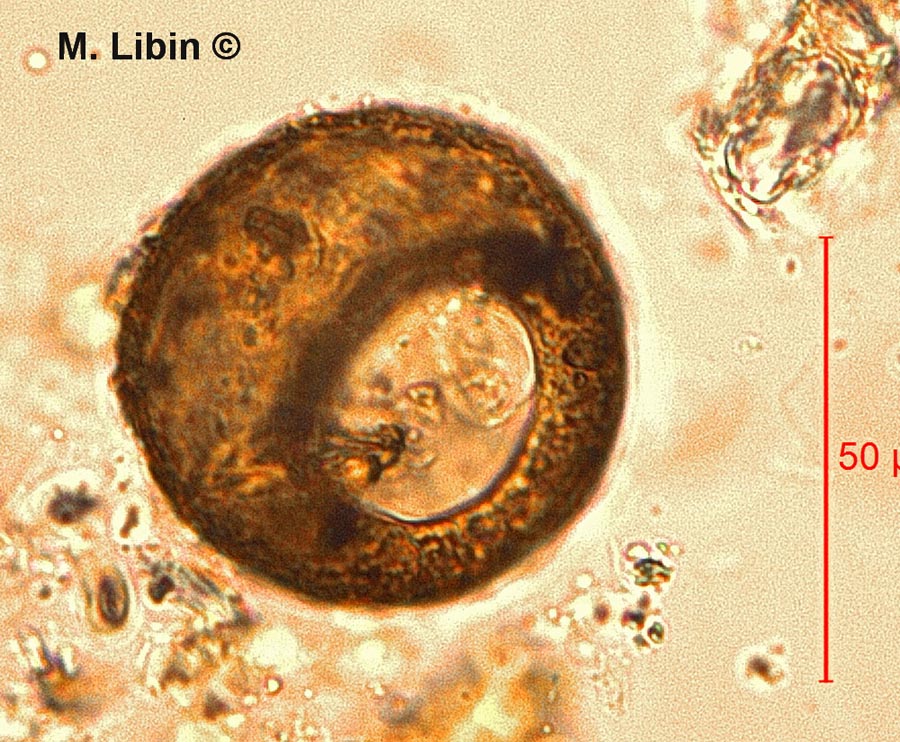 Cyclopyxis eurystoma