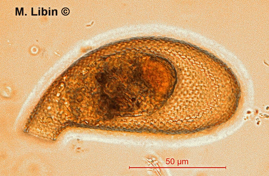 Cyphoderia ampullata