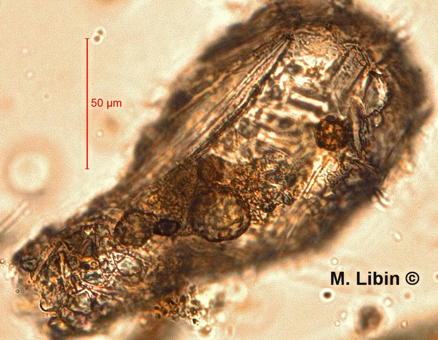 Difflugia oblonga