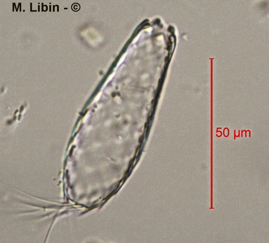 Euglypha cristata
