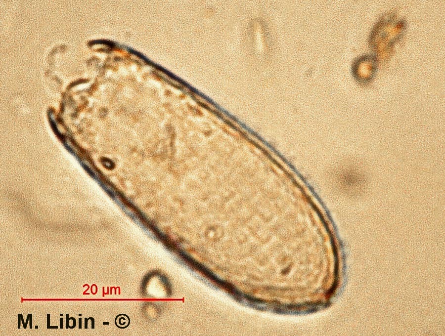 Euglypha rotunda