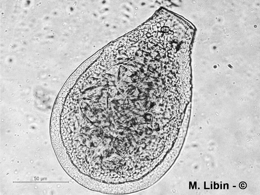 Nebela carinata