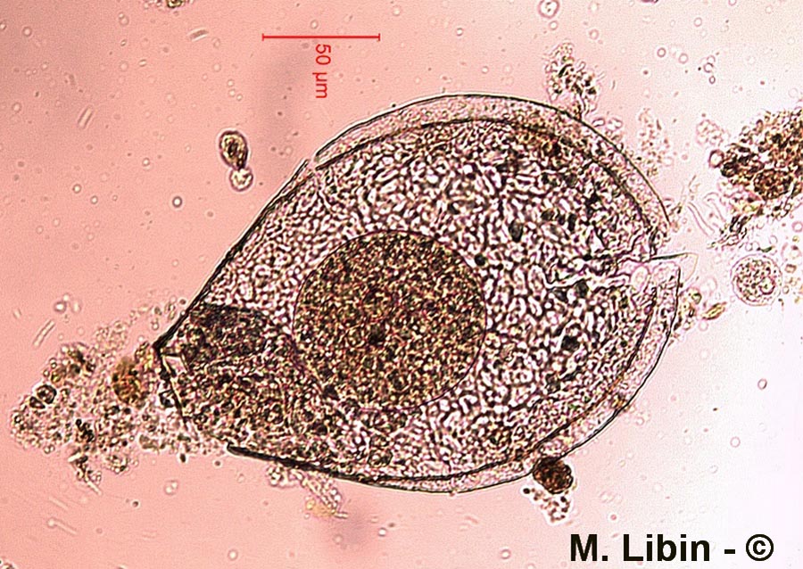 Nebela carinata