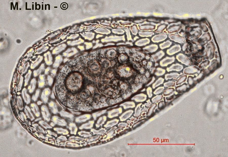 Nebela marginata