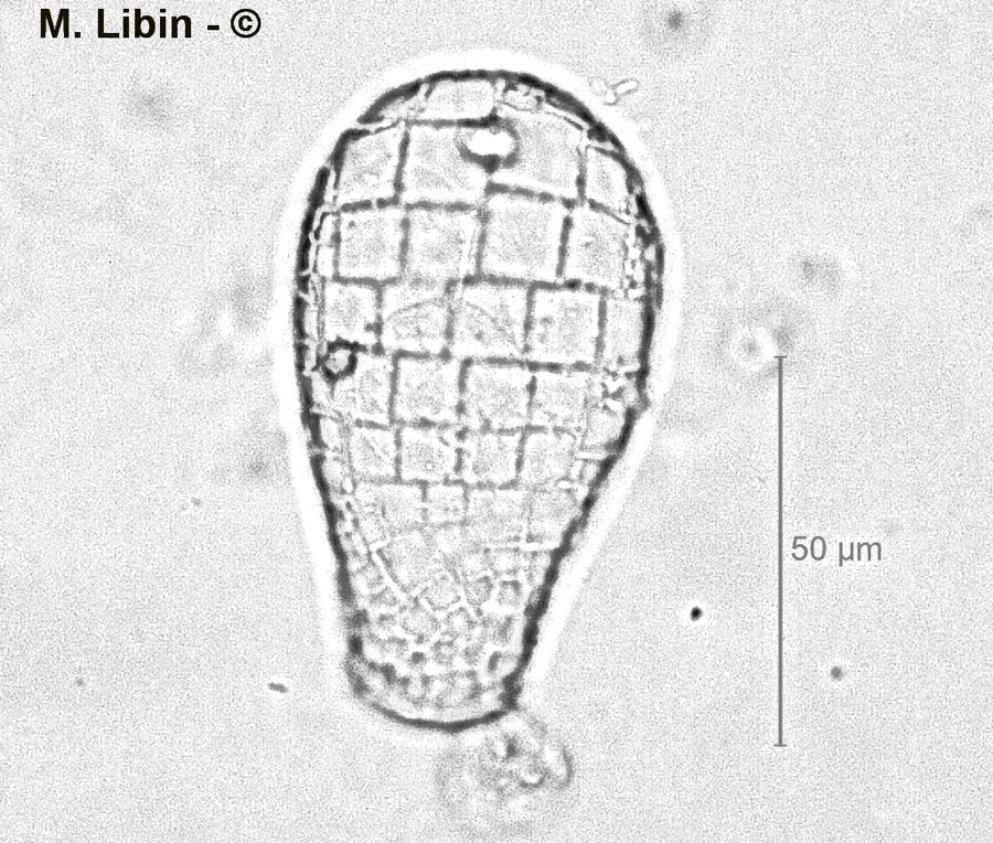 Quadrulella symetrica