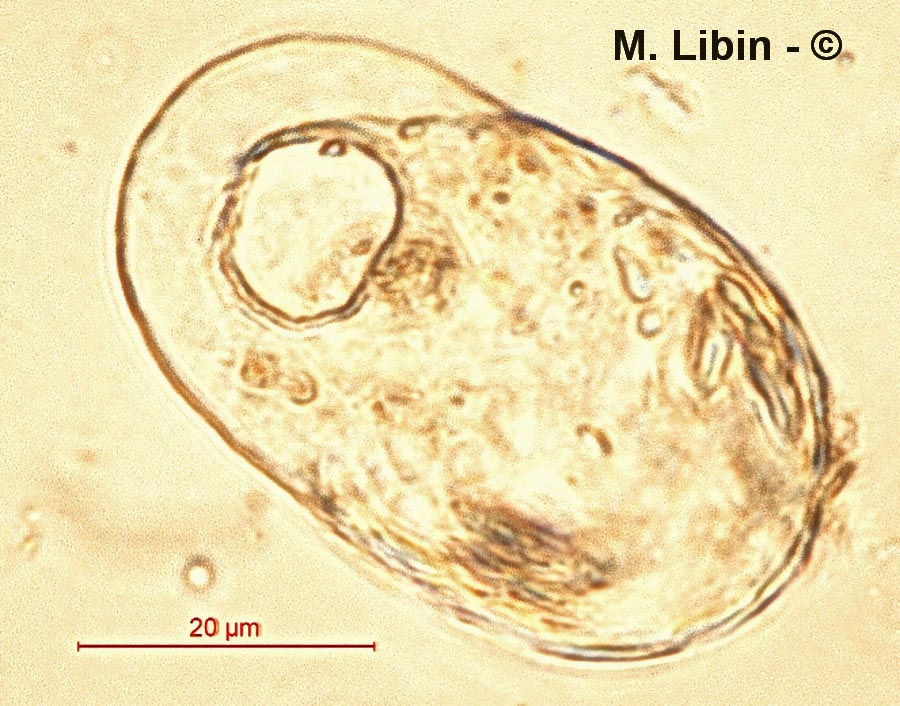 Trinema complanatum